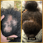 JUMBO Scalp Stimulator