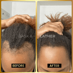 JUMBO Scalp Stimulator