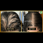 JUMBO Scalp Stimulator