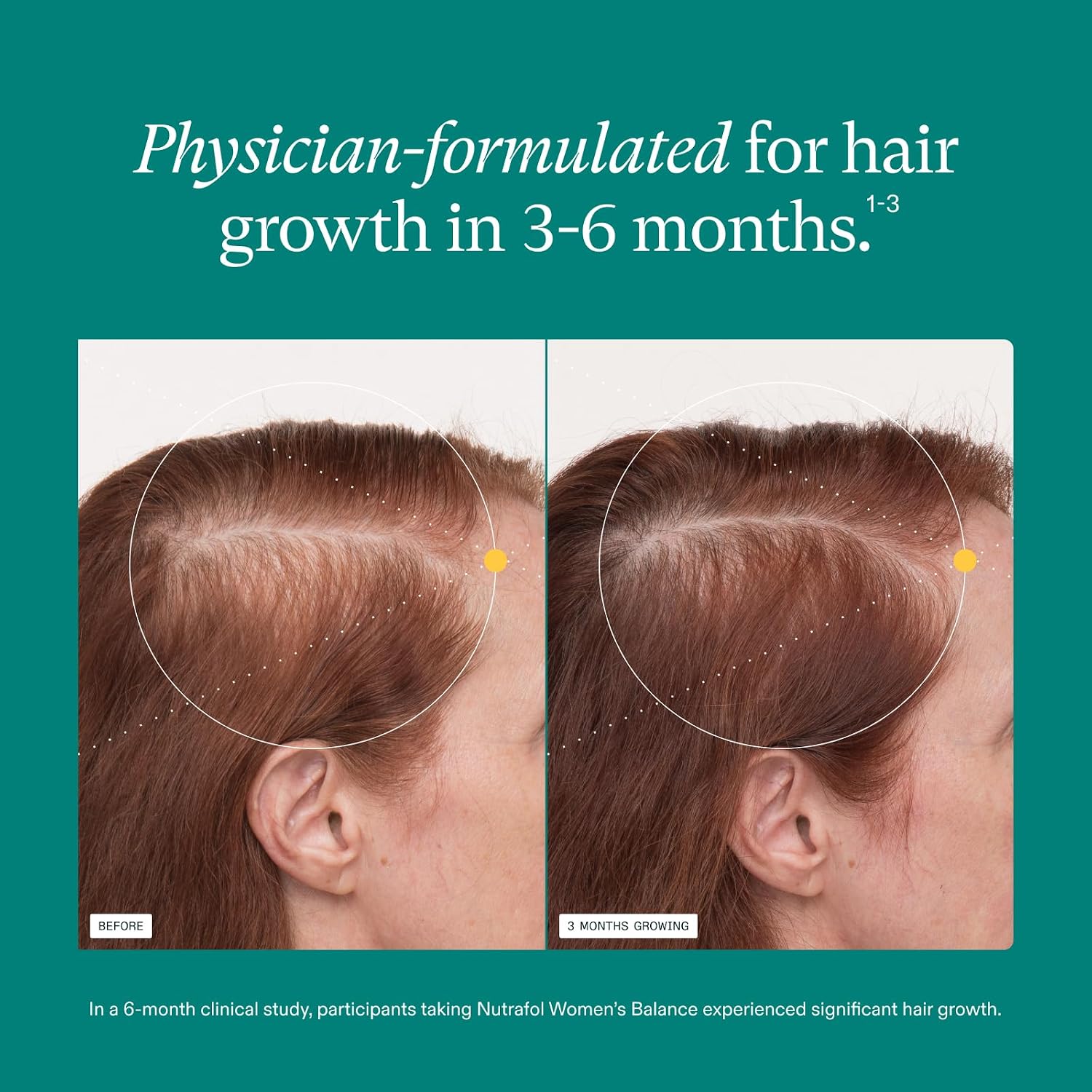 Nutrafol Women's Balance Hair Growth Supplements, Age 45+, 1-Month Bottle