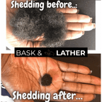 Healthy Hair Starter Kit - Limited Edition