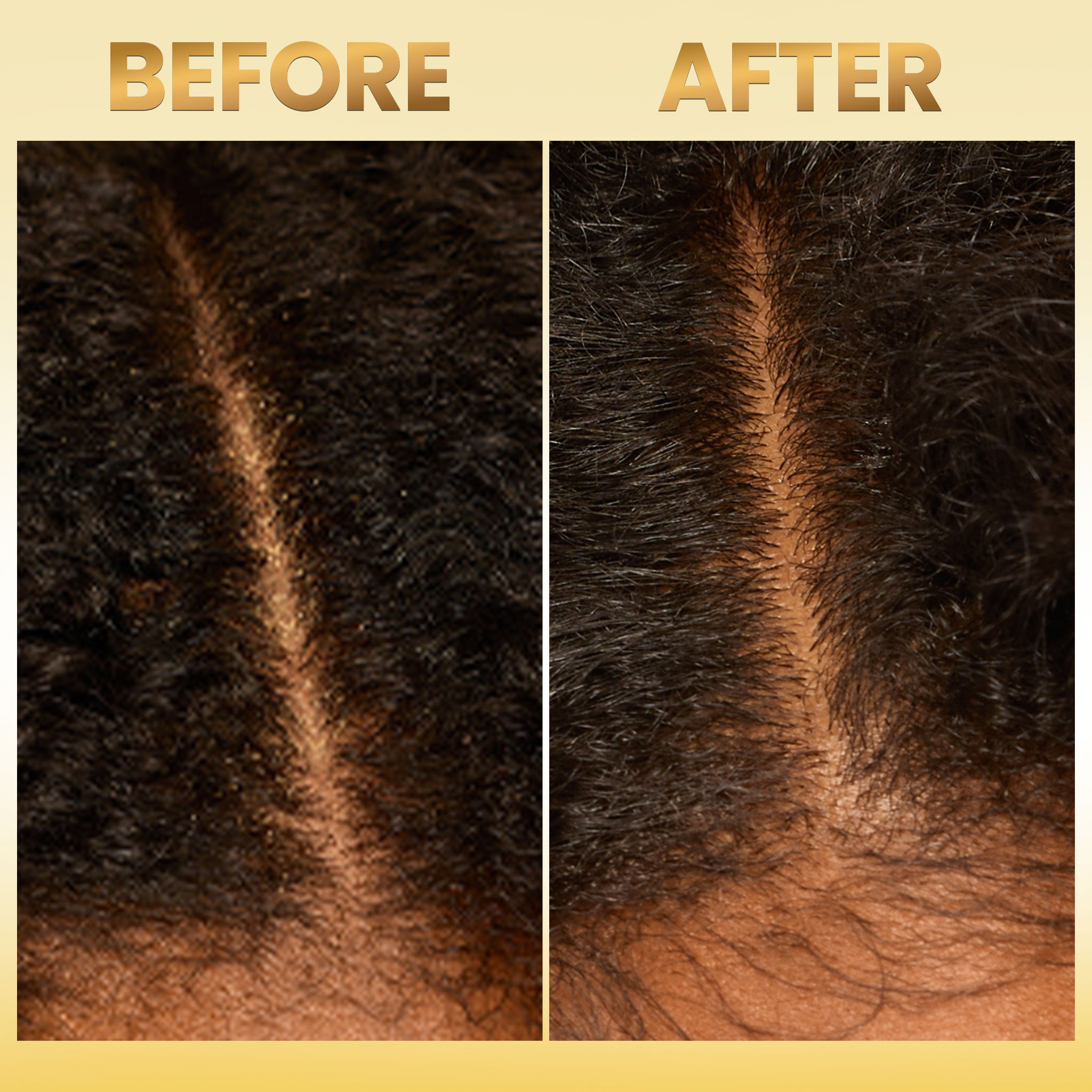 Scalp Therapy System