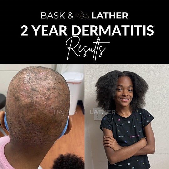 Nurture & Grow - Kids Healthy Hair Bundle