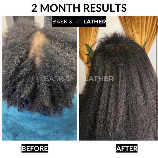 Healthy Hair Starter Kit - Limited Edition