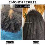 Healthy Hair Starter Kit - Limited Edition