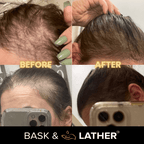 Scalp Stimulator | Hair Growth Oil